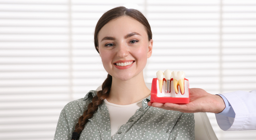 Dental Implants