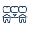 Dental Bridges
